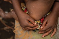 Cabo Delgado regista primeiro caso de mpox e eleva total para 70 em Mo?ambique